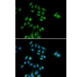 Immunofluorescence - Anti-PH3 Antibody (A91883) - Antibodies.com
