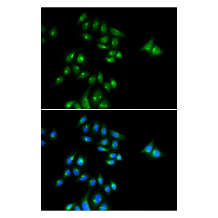 Immunofluorescence - Anti-PH3 Antibody (A91883) - Antibodies.com