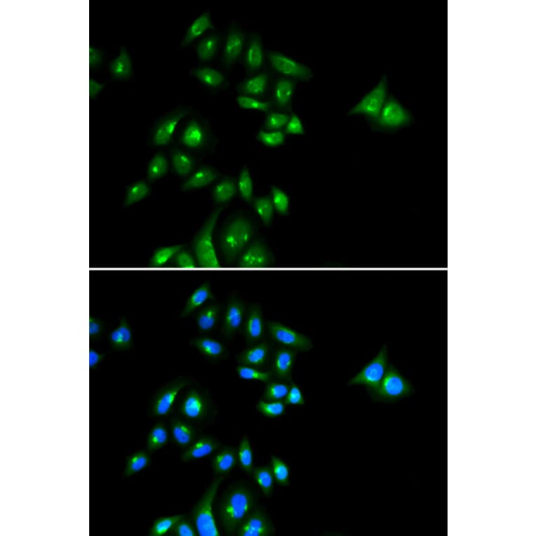 Immunofluorescence - Anti-PH3 Antibody (A91883) - Antibodies.com