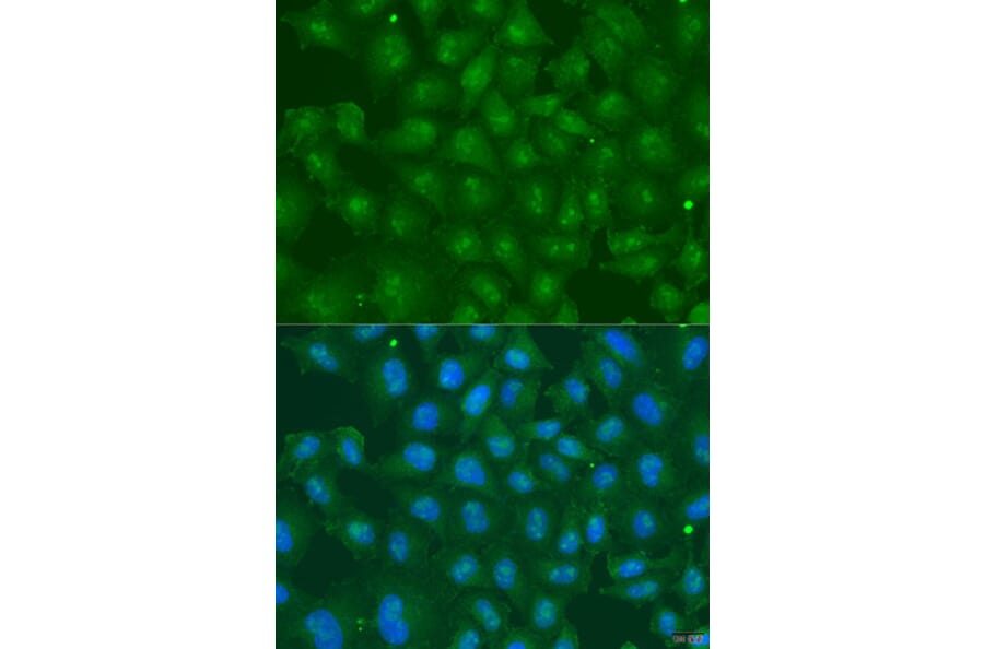 Immunofluorescence - Anti-ZBTB20 Antibody (A15149) - Antibodies.com
