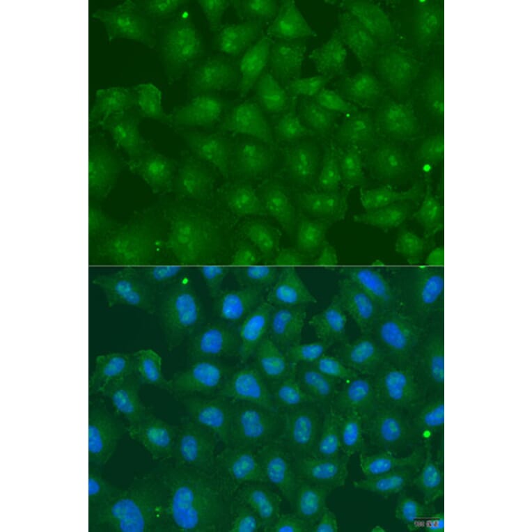 Immunofluorescence - Anti-ZBTB20 Antibody (A15149) - Antibodies.com