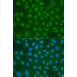 Immunofluorescence - Anti-ZBTB20 Antibody (A15149) - Antibodies.com