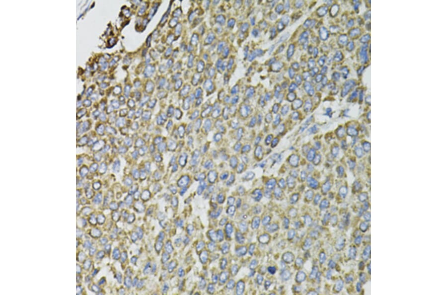 Immunohistochemistry - Anti-RASSF1 Antibody (A12567) - Antibodies.com