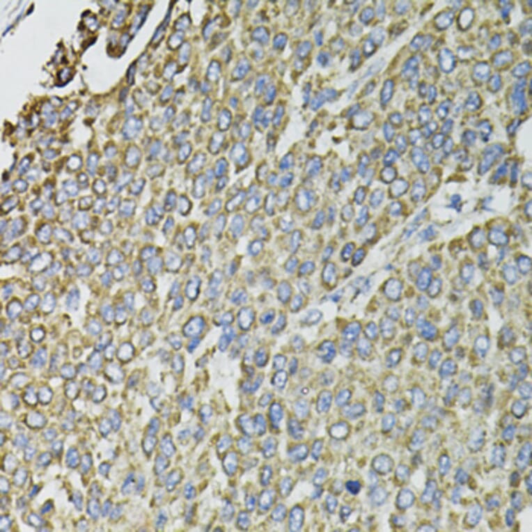 Immunohistochemistry - Anti-RASSF1 Antibody (A12567) - Antibodies.com
