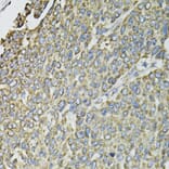 Immunohistochemistry - Anti-RASSF1 Antibody (A12567) - Antibodies.com