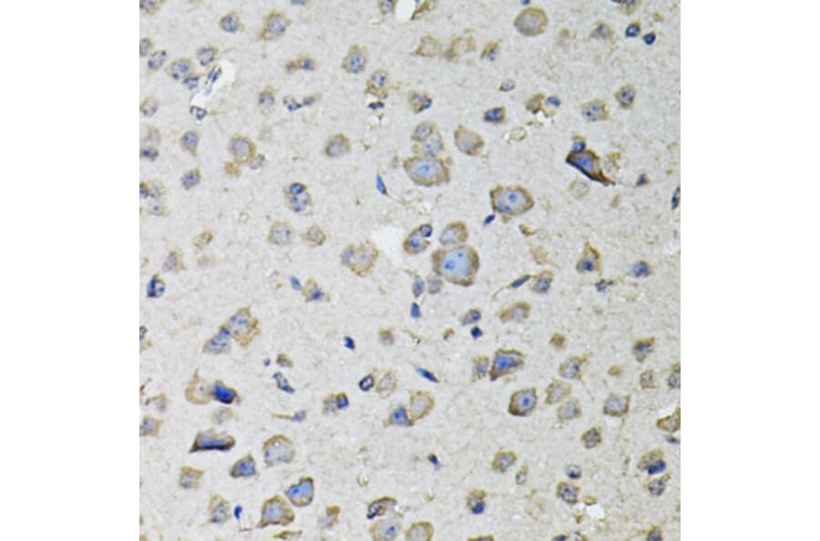 Immunohistochemistry - Anti-RASSF1 Antibody (A12567) - Antibodies.com