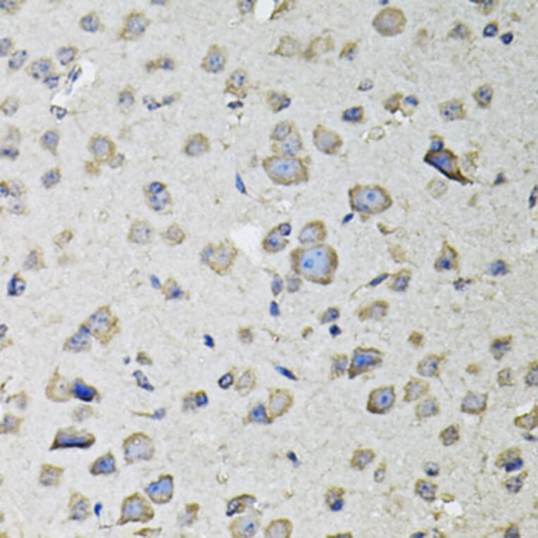 Immunohistochemistry - Anti-RASSF1 Antibody (A12567) - Antibodies.com