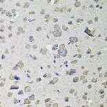 Immunohistochemistry - Anti-RASSF1 Antibody (A12567) - Antibodies.com