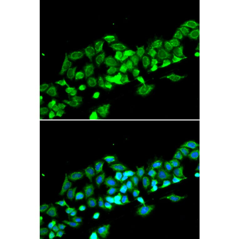 Immunofluorescence - Anti-RASSF1 Antibody (A12567) - Antibodies.com