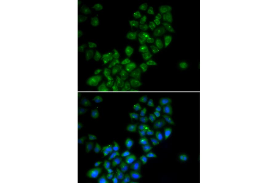Immunofluorescence - Anti-CANT1 Antibody (A14157) - Antibodies.com