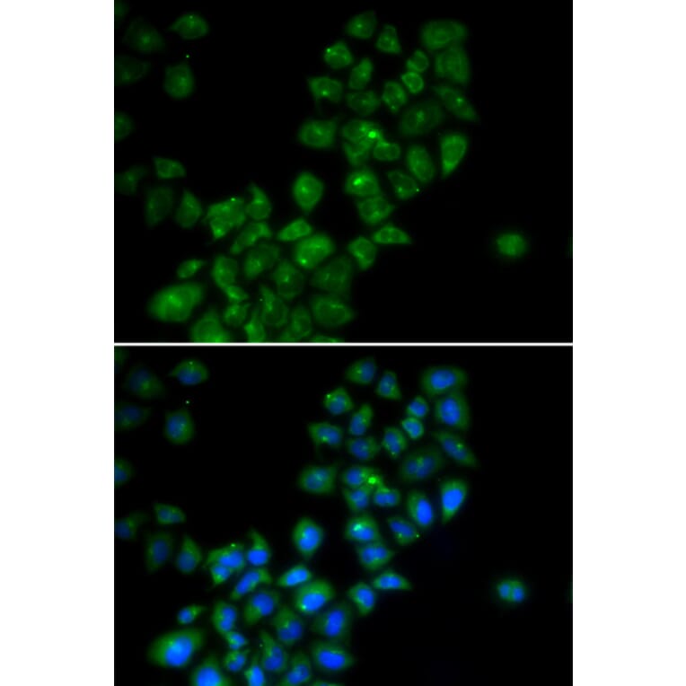Immunofluorescence - Anti-CANT1 Antibody (A14157) - Antibodies.com