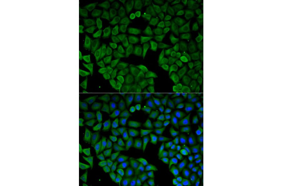 Immunofluorescence - Anti-CHRNA1 Antibody (A13287) - Antibodies.com