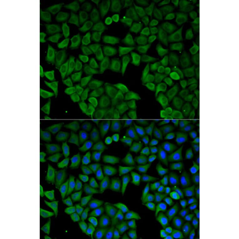 Immunofluorescence - Anti-CHRNA1 Antibody (A13287) - Antibodies.com