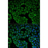 Immunofluorescence - Anti-CHRNA1 Antibody (A13287) - Antibodies.com