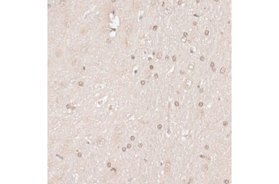 Immunohistochemistry - Anti-HMGN1 Antibody (A91893) - Antibodies.com