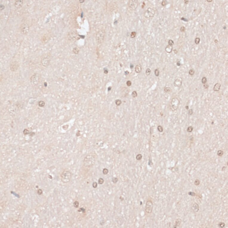 Immunohistochemistry - Anti-HMGN1 Antibody (A91893) - Antibodies.com