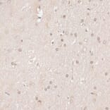 Immunohistochemistry - Anti-HMGN1 Antibody (A91893) - Antibodies.com