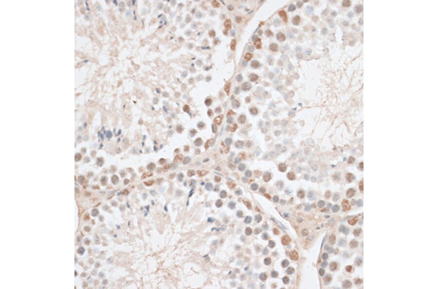 Immunohistochemistry - Anti-HMGN1 Antibody (A91893) - Antibodies.com