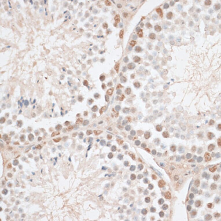 Immunohistochemistry - Anti-HMGN1 Antibody (A91893) - Antibodies.com