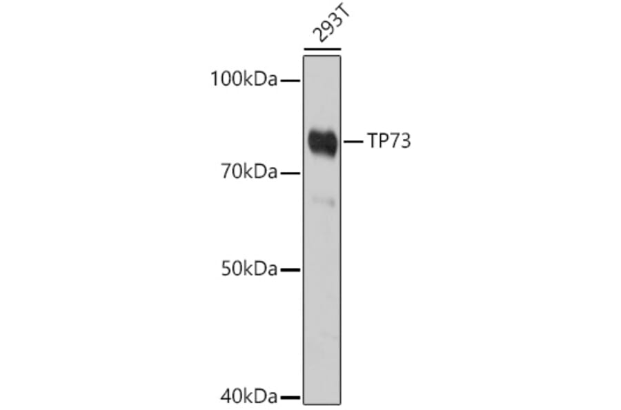 Western Blot - Anti-p73 Antibody (A91897) - Antibodies.com