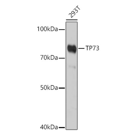 Western Blot - Anti-p73 Antibody (A91897) - Antibodies.com