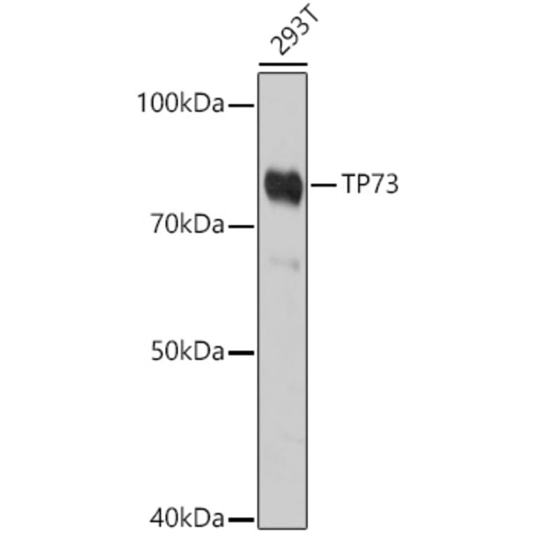 Western Blot - Anti-p73 Antibody (A91897) - Antibodies.com