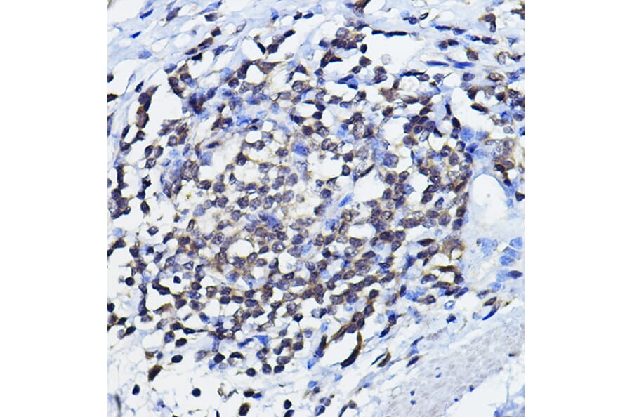 Immunohistochemistry - Anti-p73 Antibody (A91897) - Antibodies.com