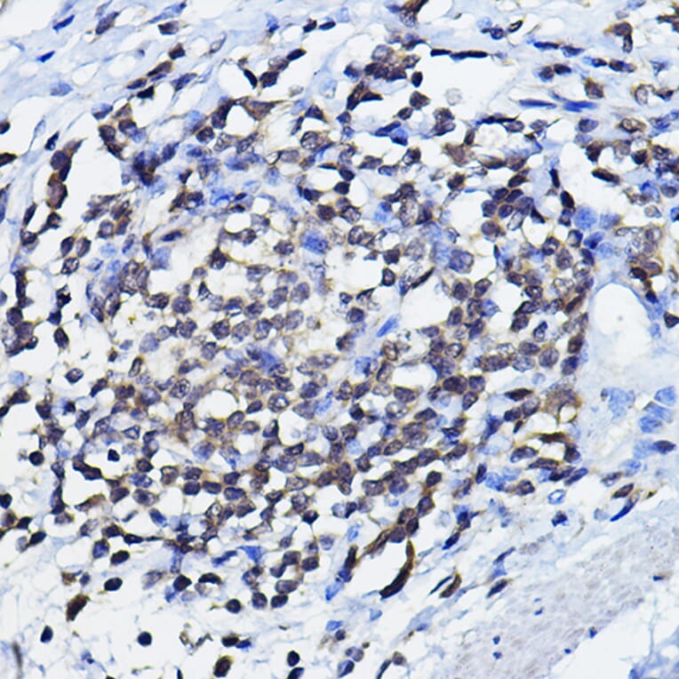 Immunohistochemistry - Anti-p73 Antibody (A91897) - Antibodies.com