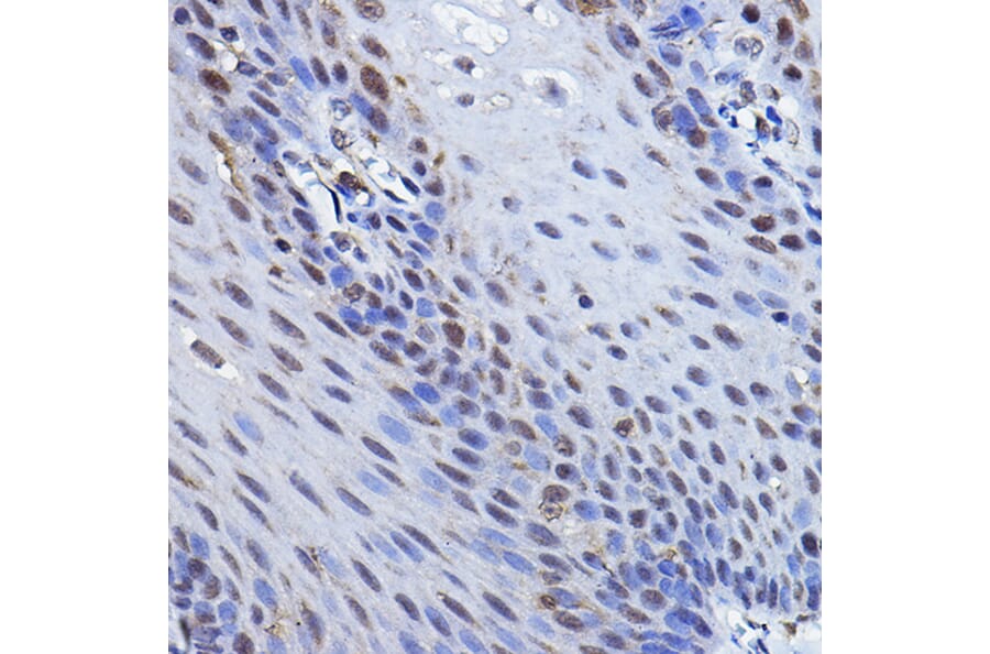 Immunohistochemistry - Anti-p73 Antibody (A91897) - Antibodies.com
