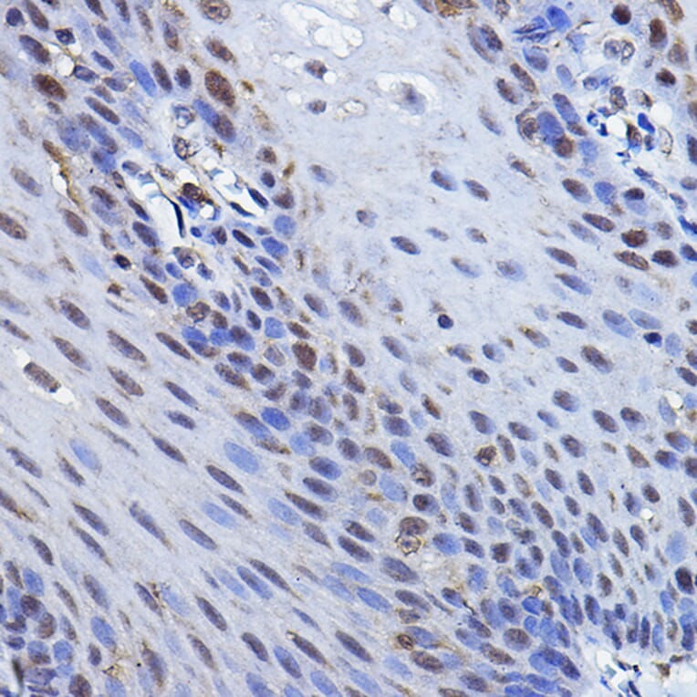 Immunohistochemistry - Anti-p73 Antibody (A91897) - Antibodies.com