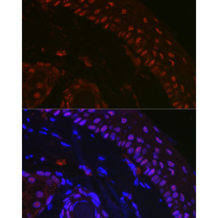 Immunofluorescence - Anti-p73 Antibody (A91897) - Antibodies.com