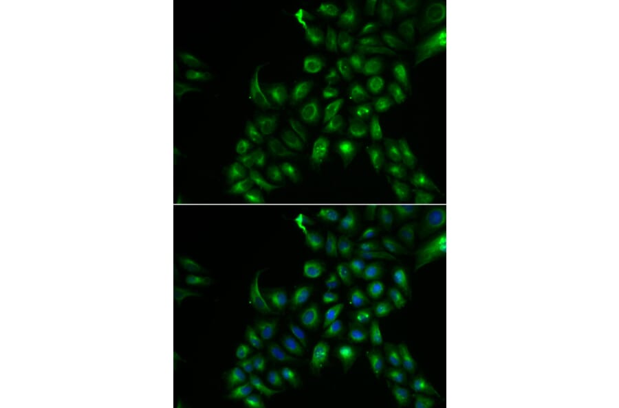 Immunofluorescence - Anti-TSPAN7 Antibody (A13554) - Antibodies.com