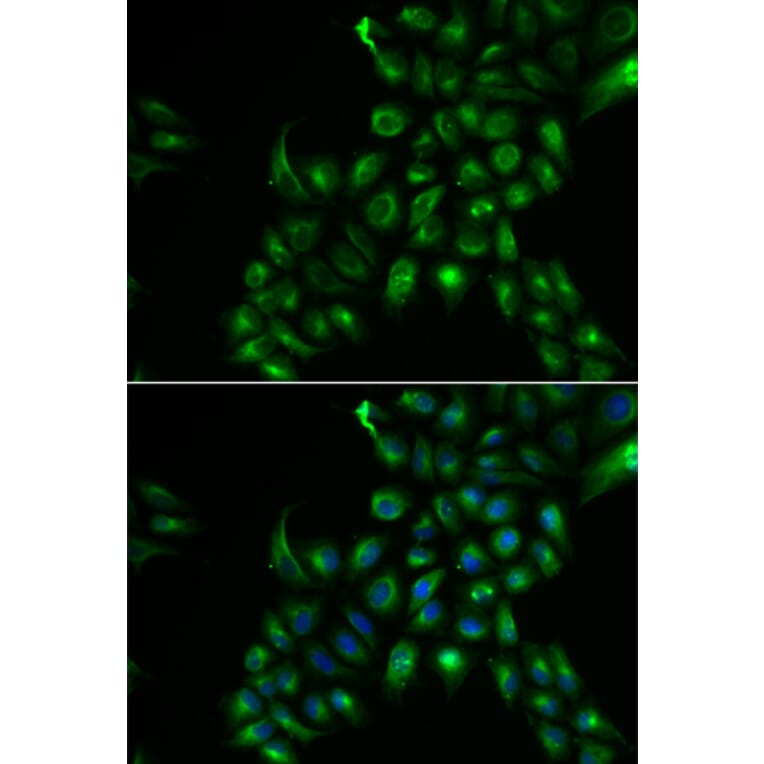 Immunofluorescence - Anti-TSPAN7 Antibody (A13554) - Antibodies.com