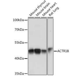 Western Blot - Anti-ACTR1B Antibody (A91903) - Antibodies.com