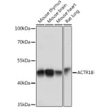 Western Blot - Anti-ACTR1B Antibody (A91903) - Antibodies.com