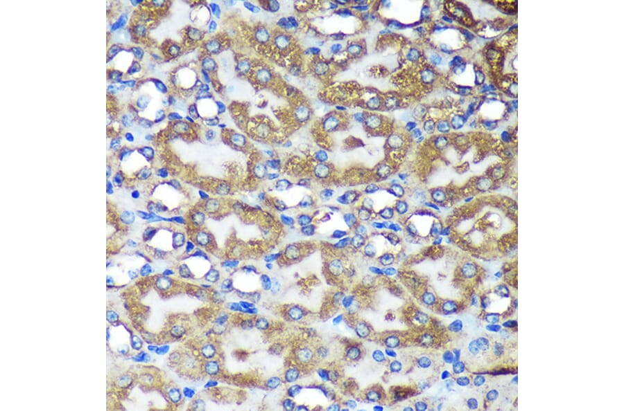 Immunohistochemistry - Anti-ACTR1B Antibody (A91903) - Antibodies.com
