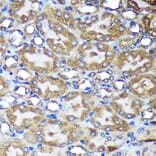 Immunohistochemistry - Anti-ACTR1B Antibody (A91903) - Antibodies.com