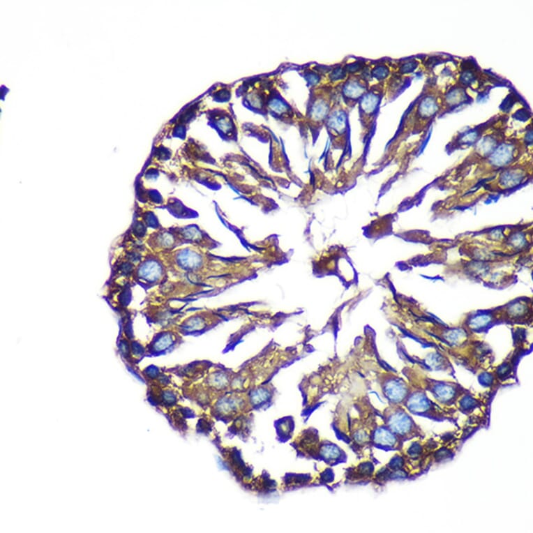 Immunohistochemistry - Anti-ACTR1B Antibody (A91903) - Antibodies.com