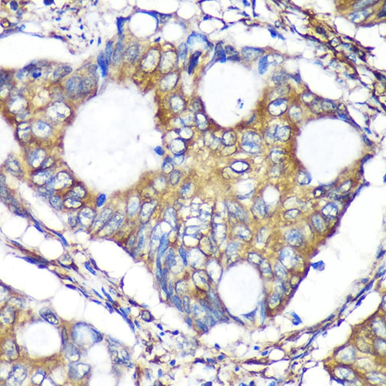 Immunohistochemistry - Anti-ACTR1B Antibody (A91903) - Antibodies.com
