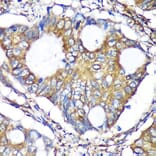 Immunohistochemistry - Anti-ACTR1B Antibody (A91903) - Antibodies.com