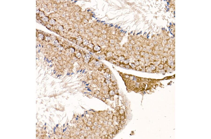Immunohistochemistry - Anti-p23 Antibody (A91906) - Antibodies.com