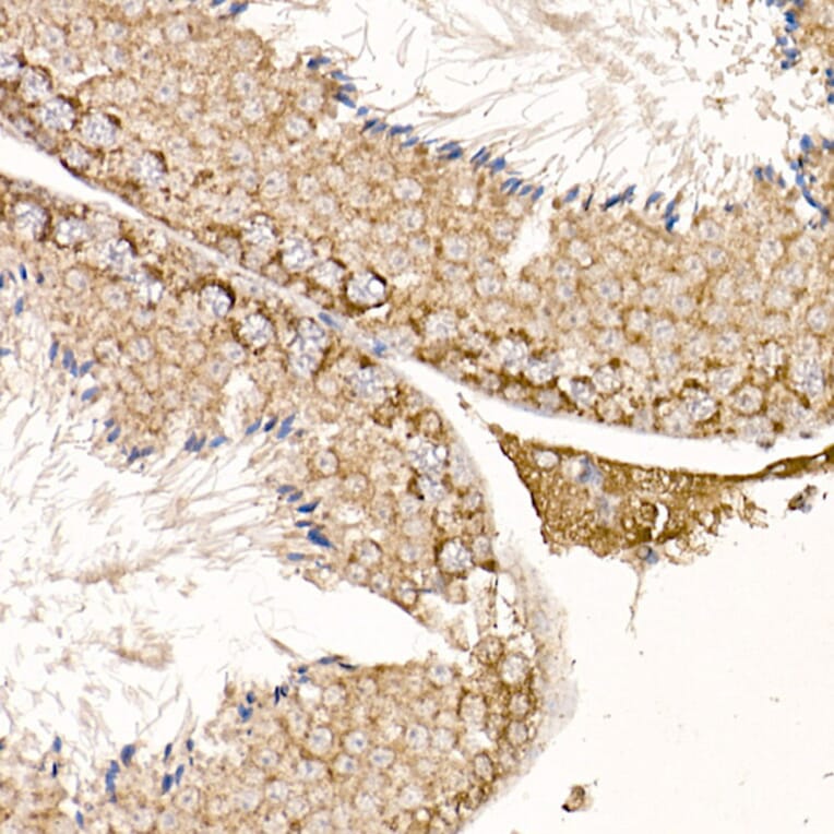 Immunohistochemistry - Anti-p23 Antibody (A91906) - Antibodies.com