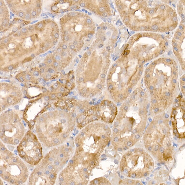 Immunohistochemistry - Anti-p23 Antibody (A91906) - Antibodies.com