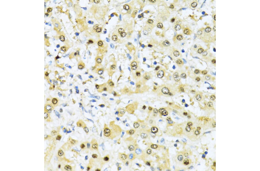 Immunohistochemistry - Anti-ITGB3BP Antibody (A91907) - Antibodies.com