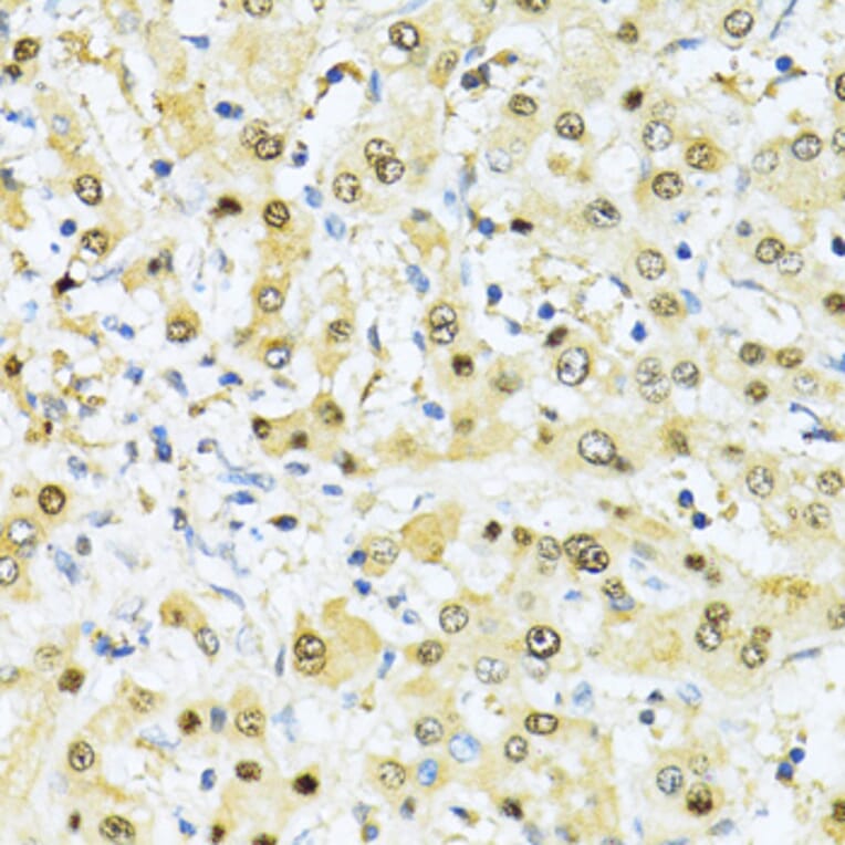 Immunohistochemistry - Anti-ITGB3BP Antibody (A91907) - Antibodies.com