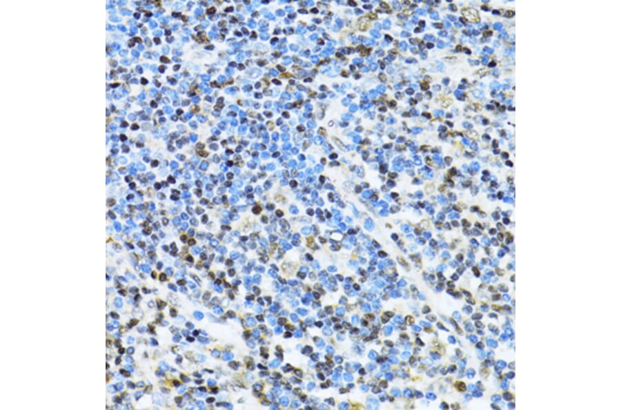Immunohistochemistry - Anti-ITGB3BP Antibody (A91907) - Antibodies.com