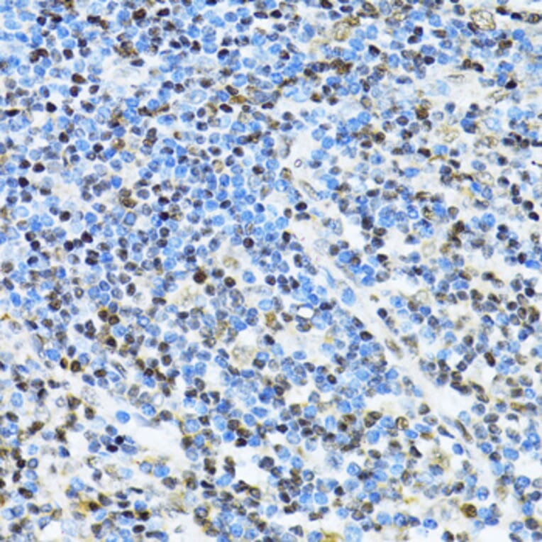 Immunohistochemistry - Anti-ITGB3BP Antibody (A91907) - Antibodies.com