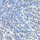 Immunohistochemistry - Anti-ITGB3BP Antibody (A91907) - Antibodies.com