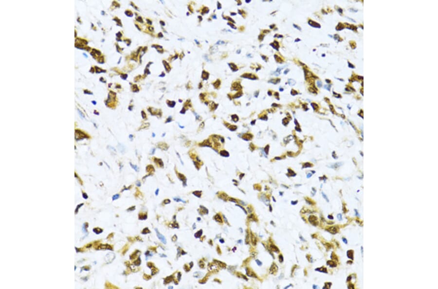 Immunohistochemistry - Anti-ITGB3BP Antibody (A91907) - Antibodies.com