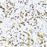 Immunohistochemistry - Anti-ITGB3BP Antibody (A91907) - Antibodies.com
